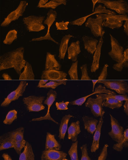 Anti-MTMR4 Antibody (CAB15349)