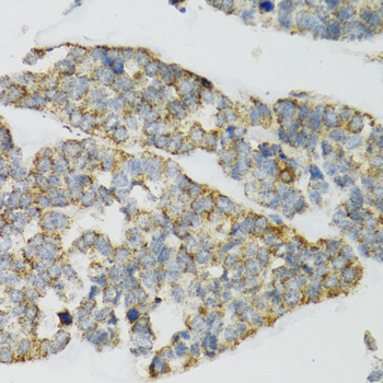 Anti-PI3 Antibody (CAB12482)