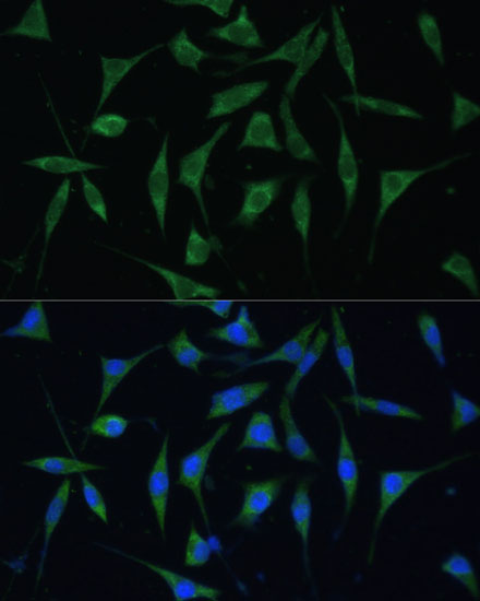 Anti-PALD1 Antibody (CAB12893)