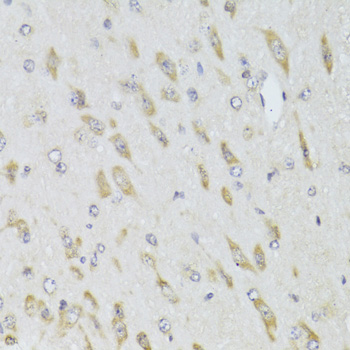 Anti-RPL13 Antibody (CAB6723)