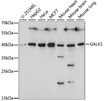 Anti-GALK1 Antibody (CAB15274)