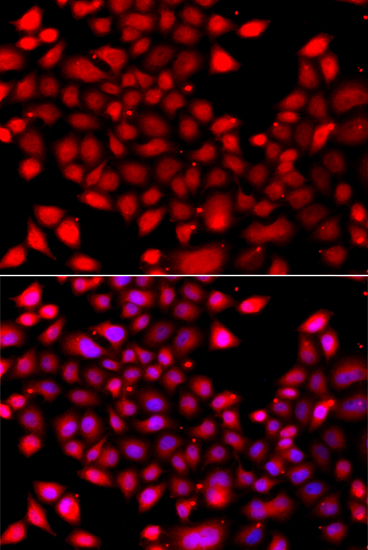 Anti-RARG Antibody (CAB7448)