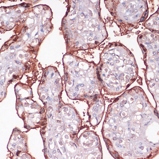 Anti-S100P Antibody (CAB14780)