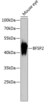 Anti-BFSP2 Antibody (CAB13055)