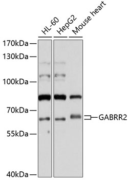 Anti-GABRR2 Antibody (CAB10111)