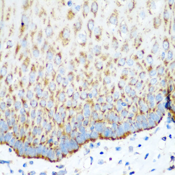 Anti-MTCO2 Antibody (CAB11522)