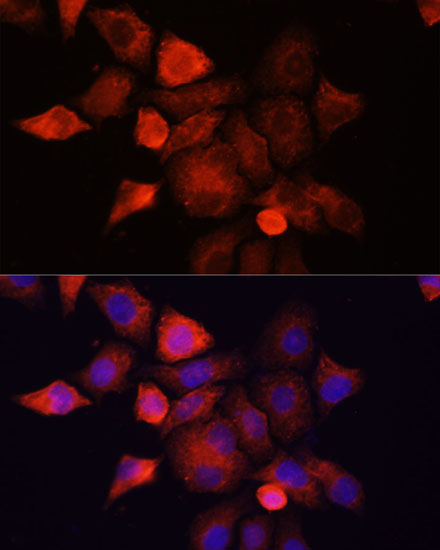 Anti-SHH Antibody (CAB7726)