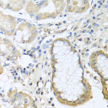 Anti-CCL11 Antibody (CAB7569)