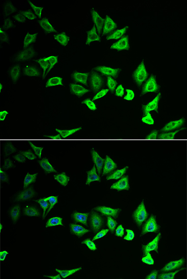 Anti-MYOZ2 Antibody (CAB6468)