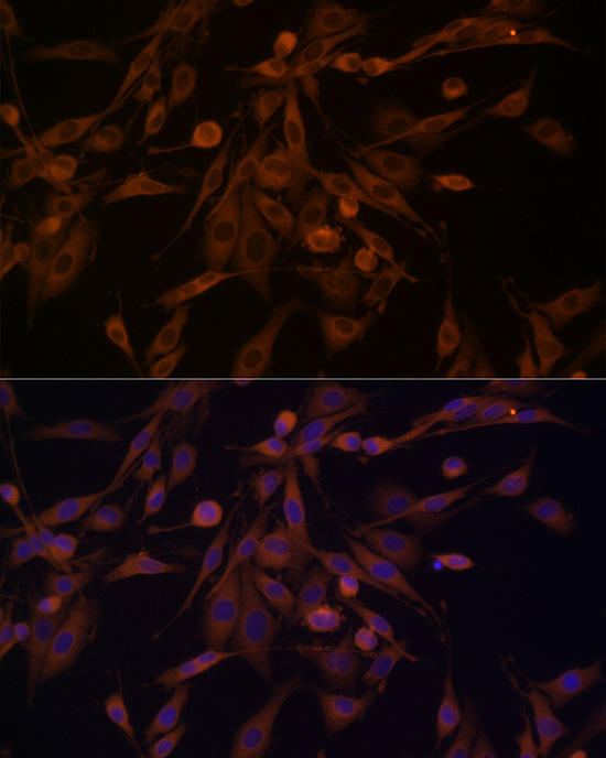 Immunofluorescence analysis of PC-12 cells using HSP70 Rabbit pAb at dilution of 1:100 (40x lens). Blue: DAPI for nuclear staining.