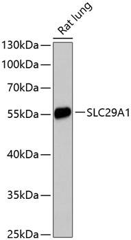 Anti-SLC29A1 Antibody (CAB13205)