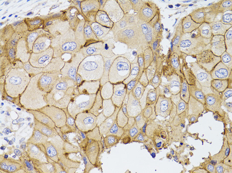 Anti-PDE4D Antibody (CAB1659)