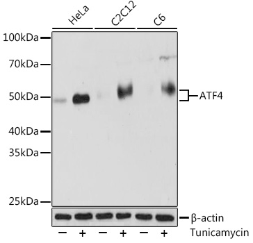 Anti-ATF4 Antibody (CAB18687)