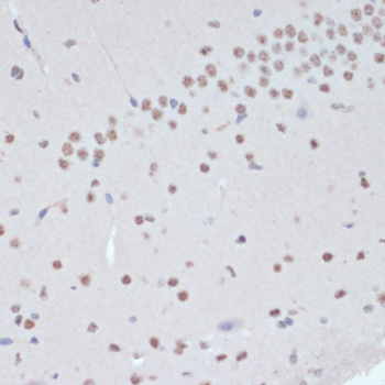 Anti-Phospho-Jak2-Y1007/1008 Antibody (CABP0531)