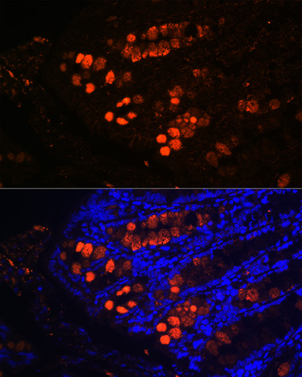 Anti-ITLN1 Antibody (CAB7234)