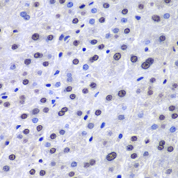 Anti-APEX1 Antibody (CAB1117)