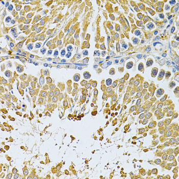 Anti-PIBF1 Antibody (CAB3072)