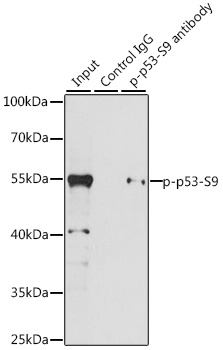 Anti-Phospho-p53-S9 Antibody (CABP0085)