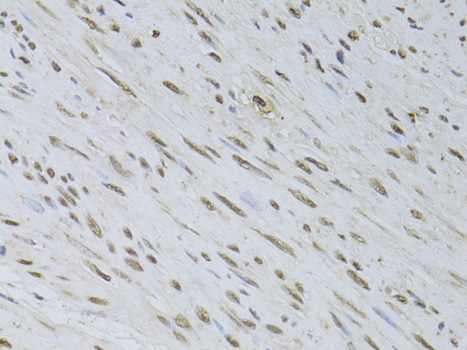 Anti-HDGFRP3 Polyclonal Antibody (CAB8815)