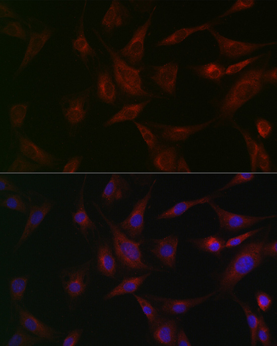 Anti-NSF Antibody (CAB0926)