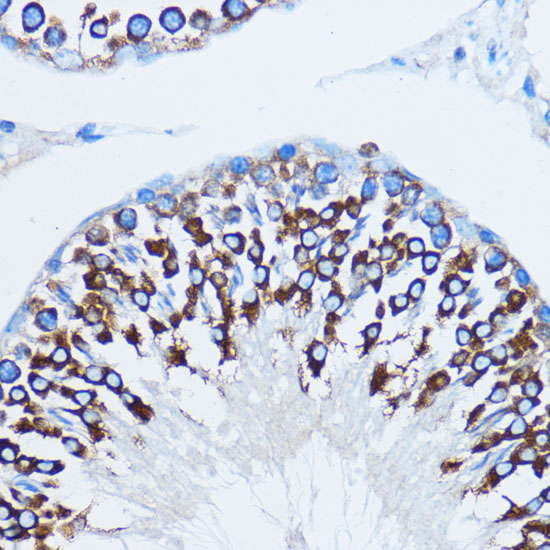 Anti-YBX1 Antibody [KO Validated] (CAB7704)