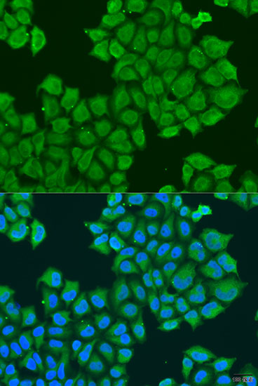 Anti-Syntaxin-12 Polyclonal Antibody (CAB8200)