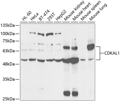 Anti-CDKAL1 Antibody (CAB5771)