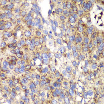 Anti-SPARC Antibody (CAB1615)