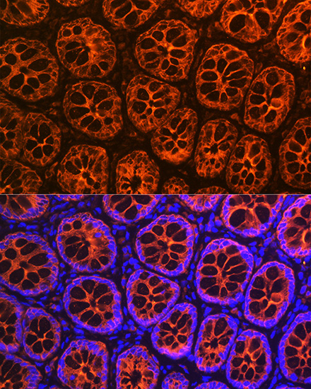 Anti-KRT19 Antibody (CAB0247)