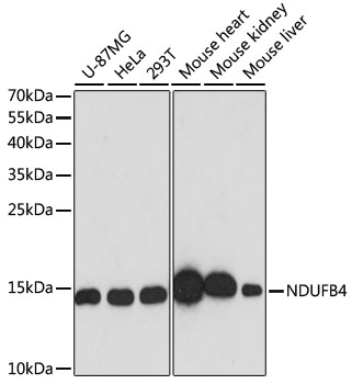 Anti-NDUFB4 Antibody [KO Validated] (CAB13820)