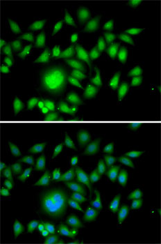 Anti-ATOH1 Antibody (CAB6530)