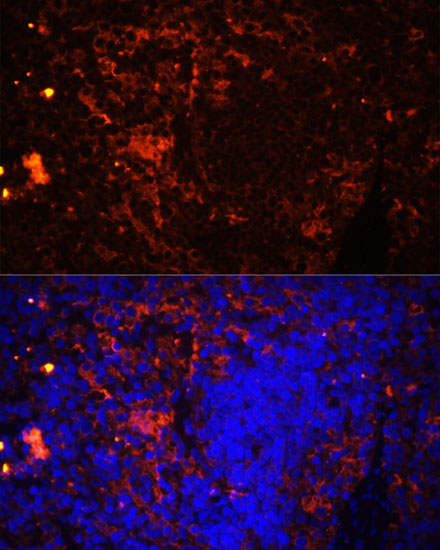 Anti-CD11A Antibody (CAB1644)