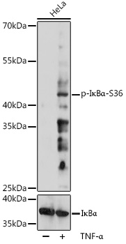 Phospho-IkBAlpha-S36 Rabbit Polyclonal Antibody (CABP1069)