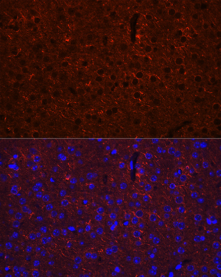 Anti-GAD2 Antibody (CAB0971)