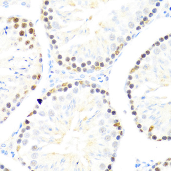 Anti-DDX50 Polyclonal Antibody (CAB8628)