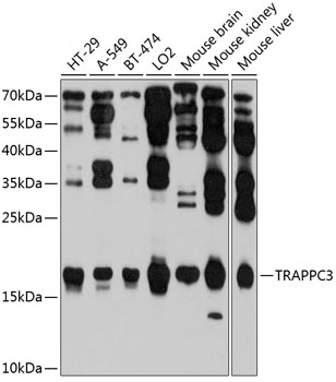 Anti-TRAPPC3 Polyclonal Antibody (CAB9113)