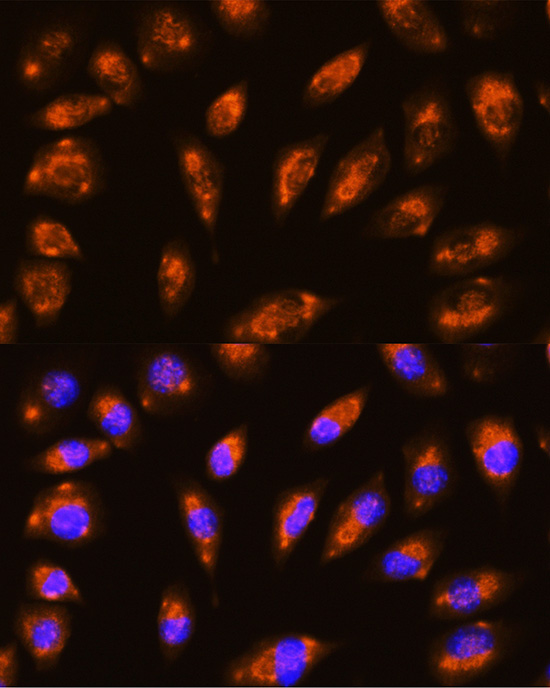 Anti-GRID1 Polyclonal Antibody (CAB8011)