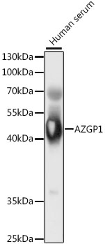 Anti-AZGP1 Antibody (CAB5365)