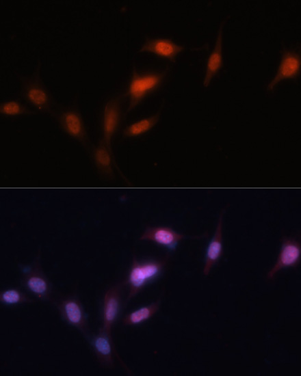 Anti-SIRT1 Antibody [KO Validated] (CAB17307)