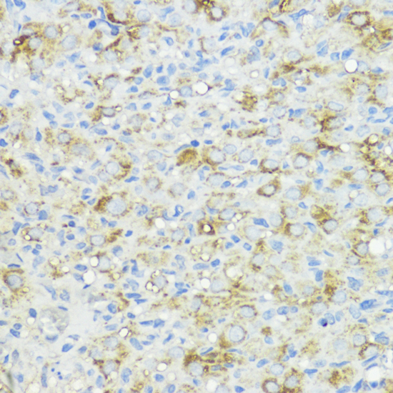 Anti-BMPR1B Antibody (CAB17858)