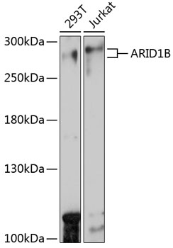 Anti-ARID1B Antibody (CAB15488)