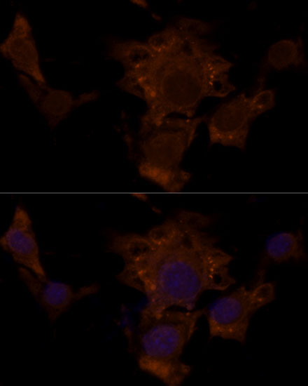 Anti-TSC2 Antibody (CAB16007)