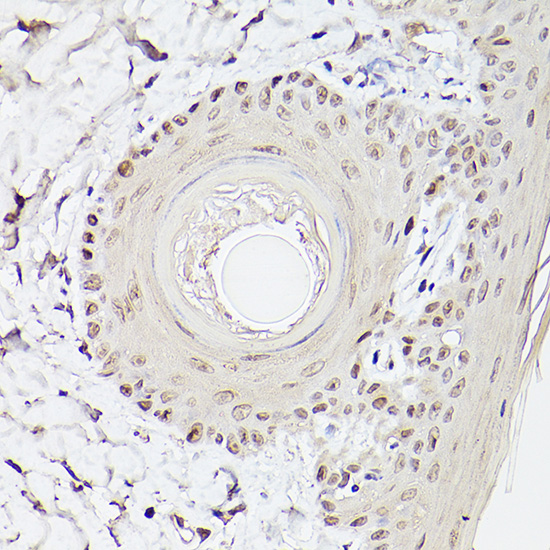 Anti-Pea3 / ETV4 Antibody (CAB5797)