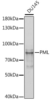 Anti-PML Antibody [KO Validated] (CAB1184)