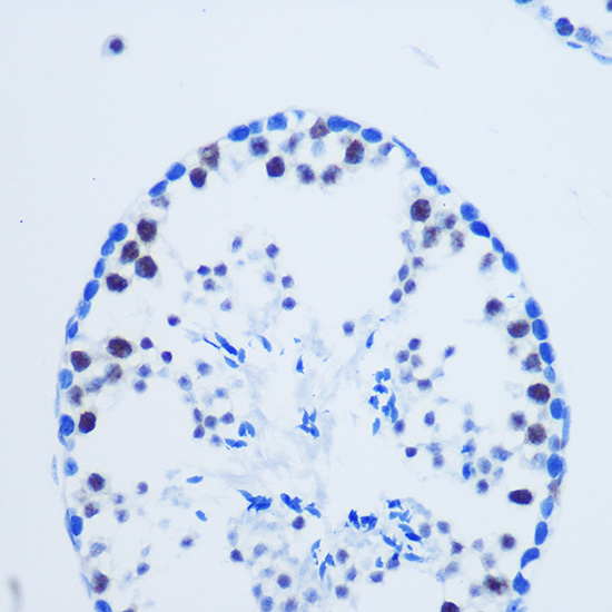 Anti-Asymmetric DiMethyl-Histone H3-R8 Antibody (CAB3157)