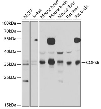 Anti-COPS6 Antibody (CAB7072)