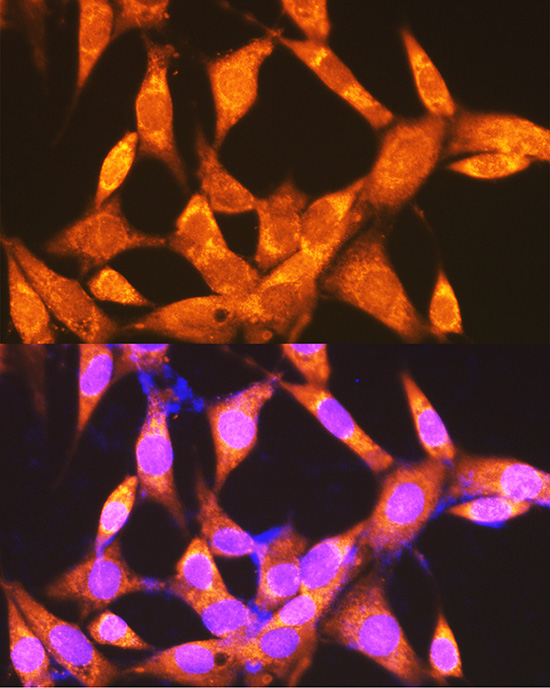 Anti-PCK2 Polyclonal Antibody (CAB8446)