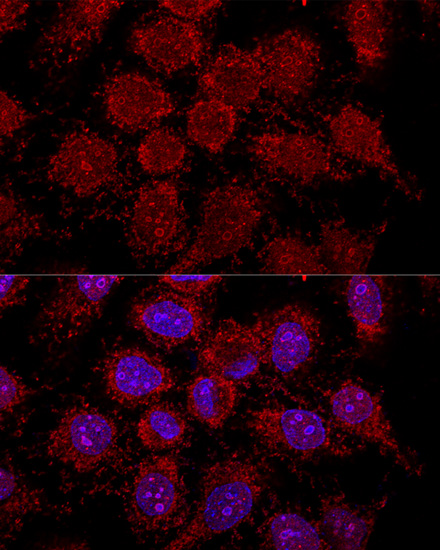 Anti-RPL30 Antibody (CAB13690)