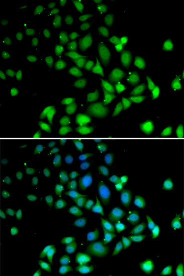 Anti-PARN Antibody (CAB4002)