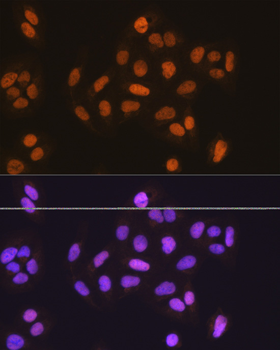 Anti-MCM5 Antibody (CAB5556)